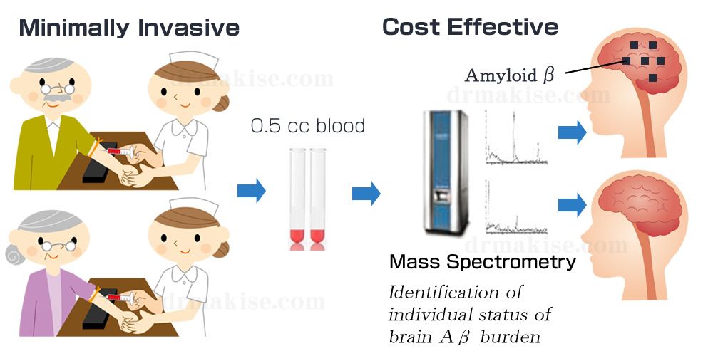 blood test predict alzheimer's disease